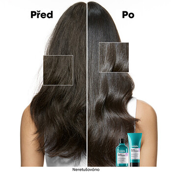 Scalp Advanced Anti-Discomfort Shampoo - Zklidňující šamppon pro citlivou vlasovou pokožku